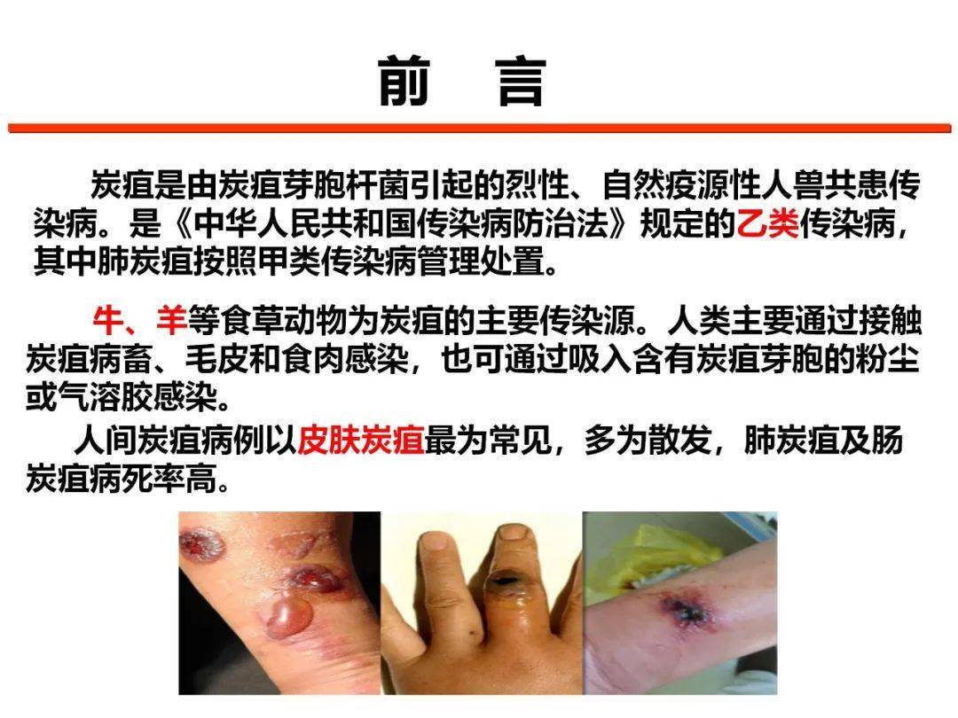 培训视频人兽共患病防控系列培训之动物炭疽的防控