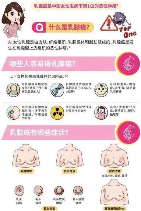 乳腺病的症状有哪些图片