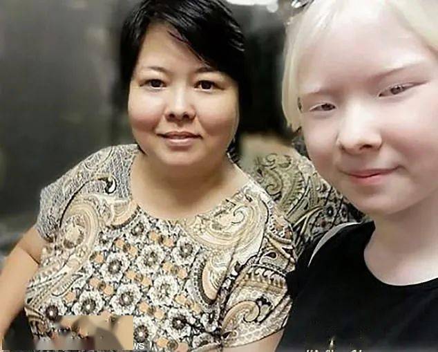 白化病姐妹罕见美照曝光引6万粉丝赞叹看一眼就忘不掉