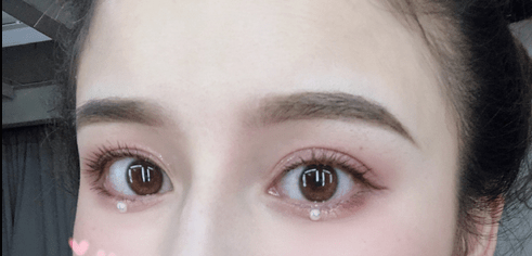 附真人效果|20岁 女生必吃的这件保养品,让你的眼睛看起来年轻10岁!