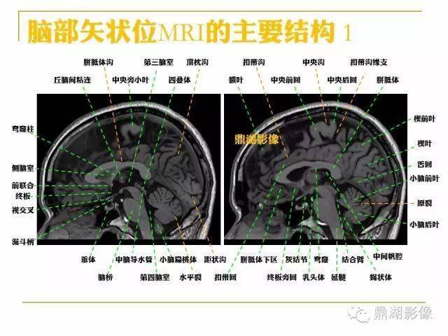 头部详细断层解剖