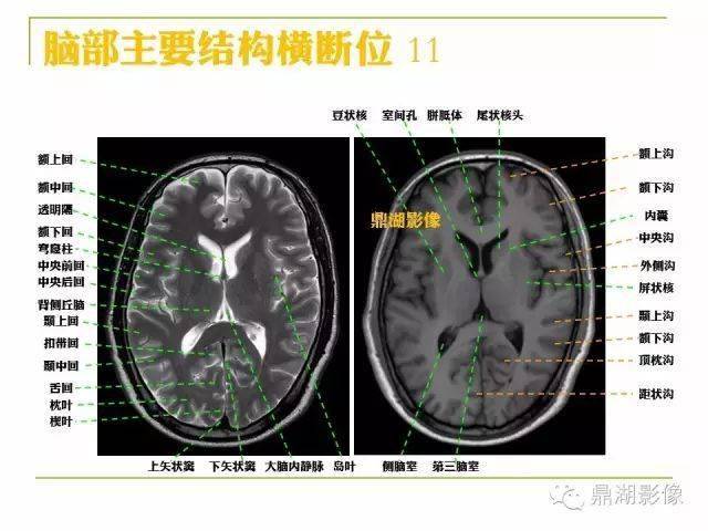 头部详细断层解剖