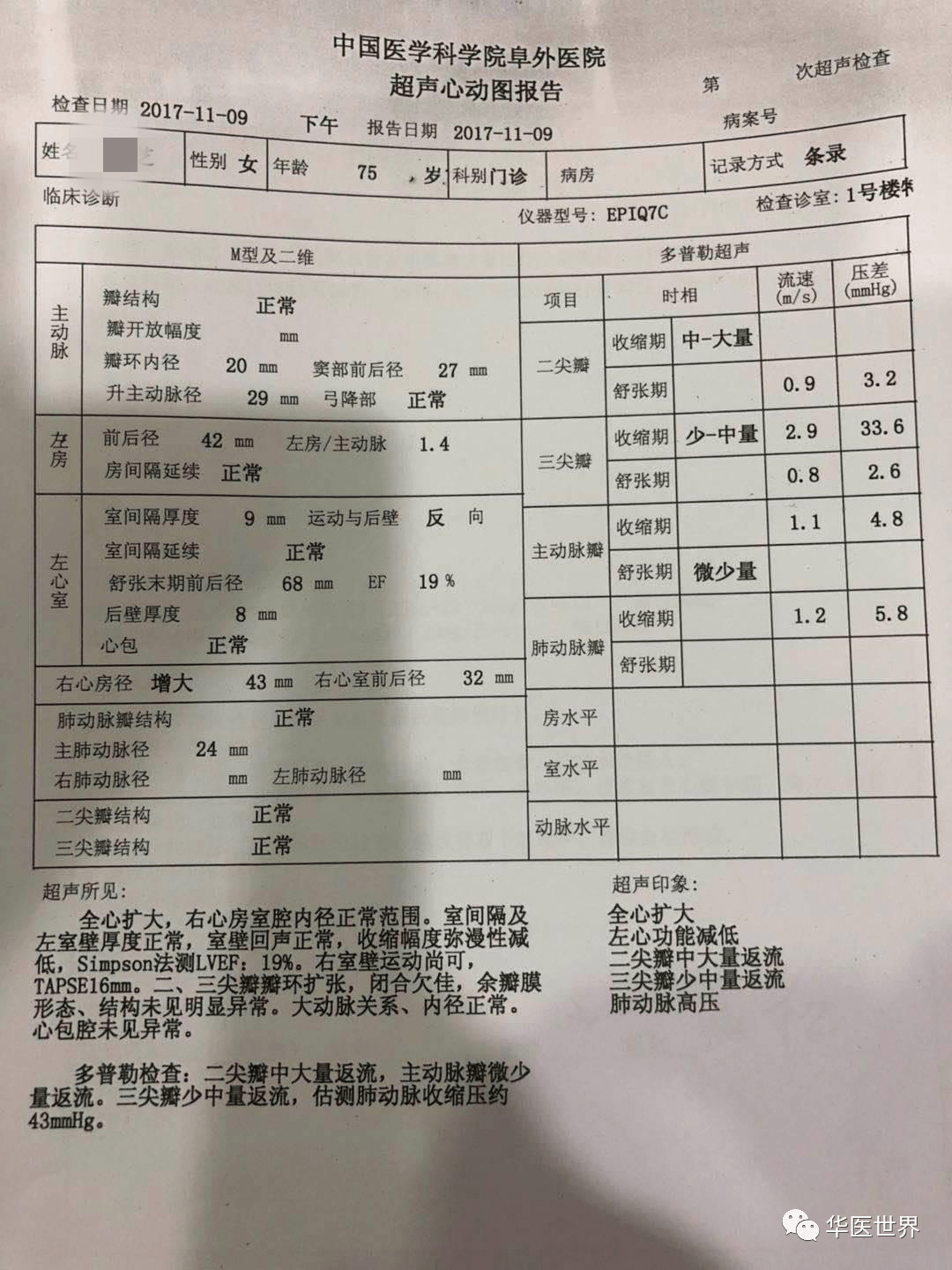 看到患者的心脏射血指数ef只有19%(正常值在50%~70%),这时候的诊断为