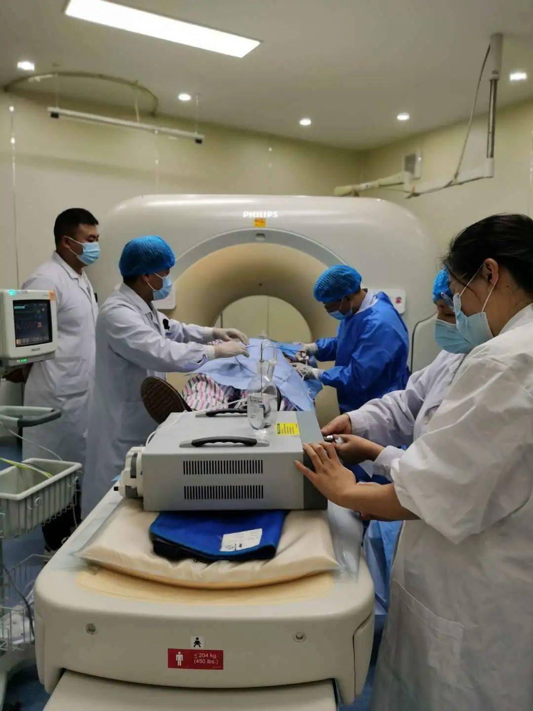 肺癌放疗定位图片