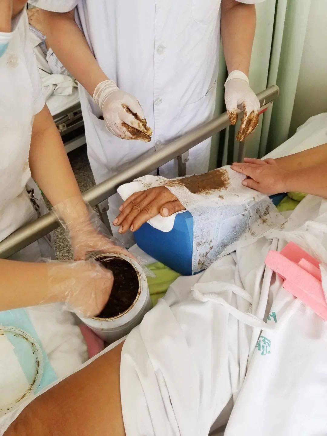 中医中药显神威中西医结合治疗骨折在聊城市二院创伤骨科率先开展