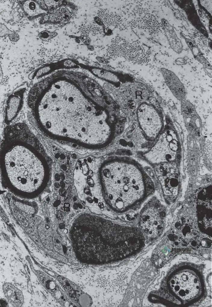 有髓神经纤维电镜图片