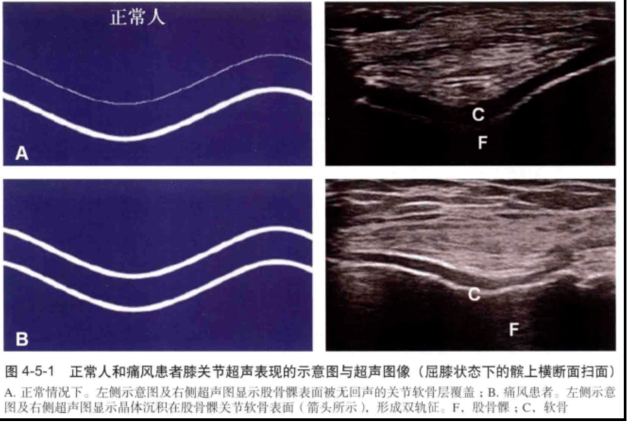 李医生讲故事帅大叔像中了面目全非脚只因吃了这种抗痛风药