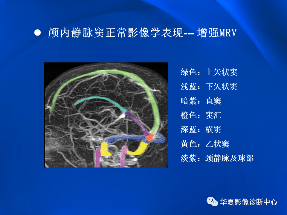 学习不倦颅内静脉窦血栓形成的影像学表现