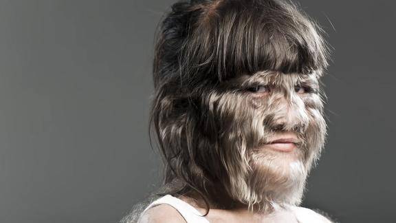 满脸长毛的狼人女孩剃毛之后长这样之后找到真爱