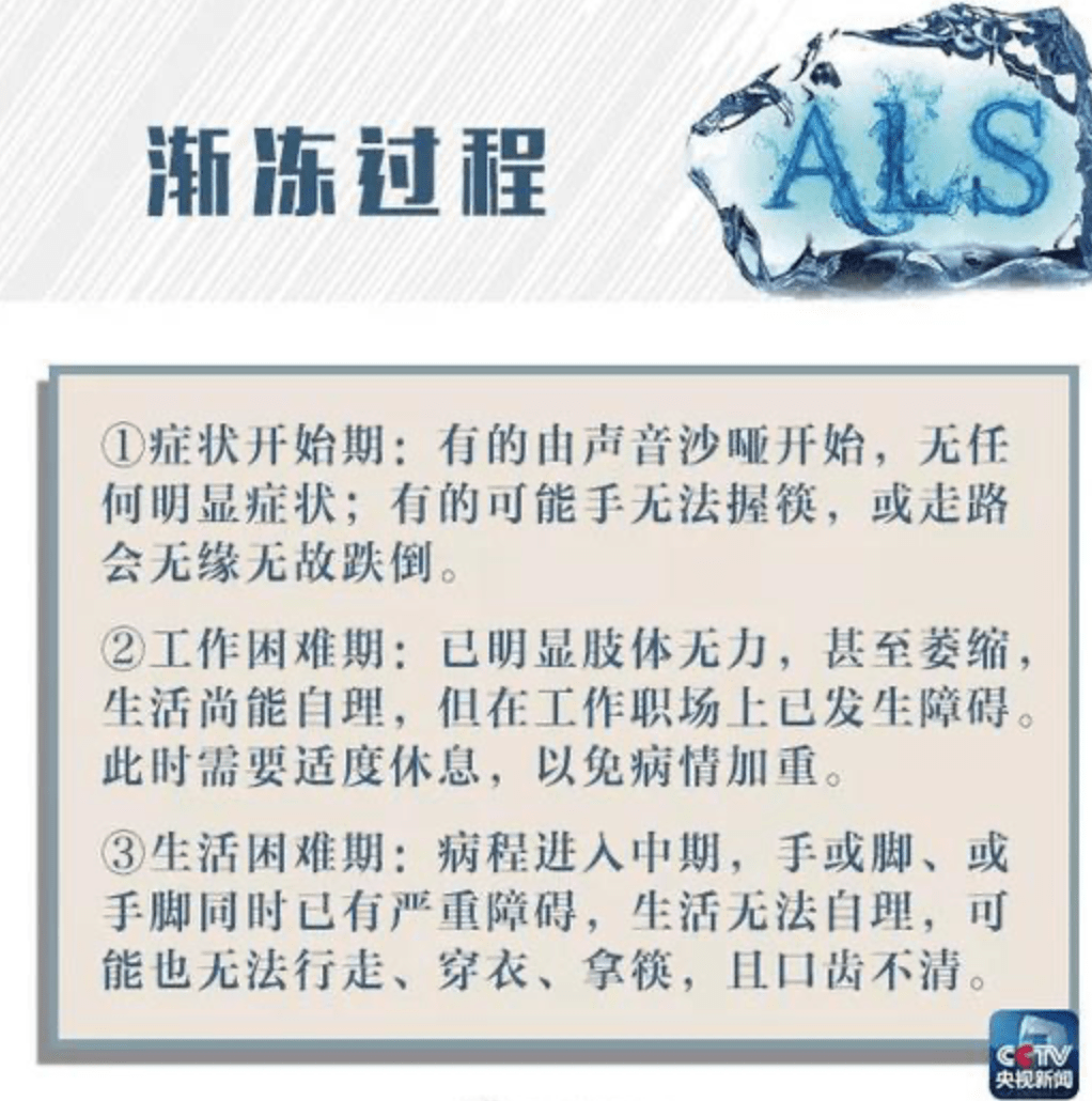 渐冻症患者有药了张定宇走路时步履蹒跚着实让人心疼