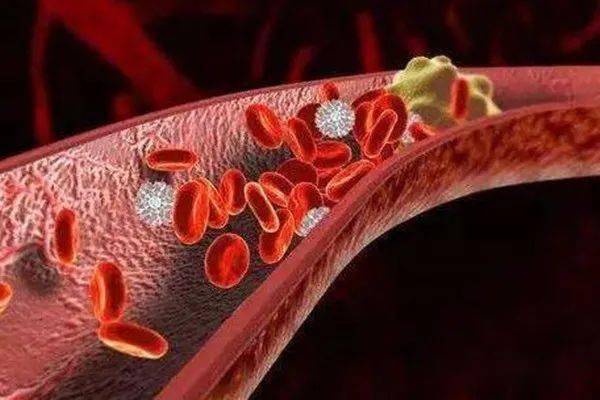 承德县医院召开院内静脉血栓栓塞症vte防治项目启动会