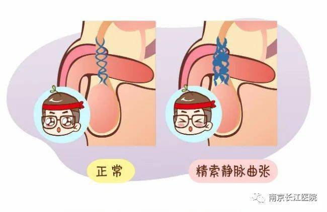 長江科普男性精子活力差是什麼原因導致的