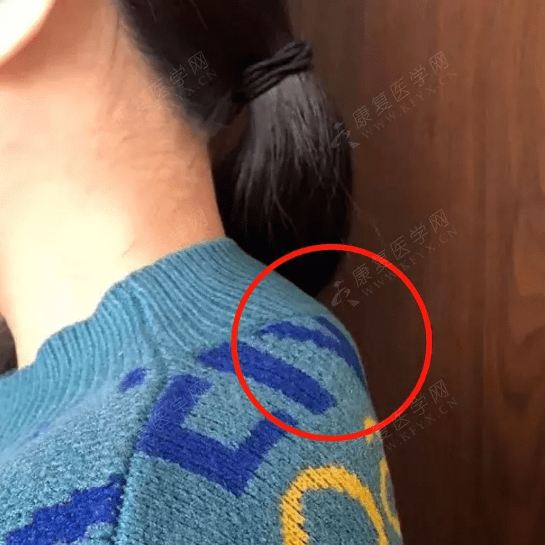 颈后大包怎么办评估手法训练三方面着手消除富贵包