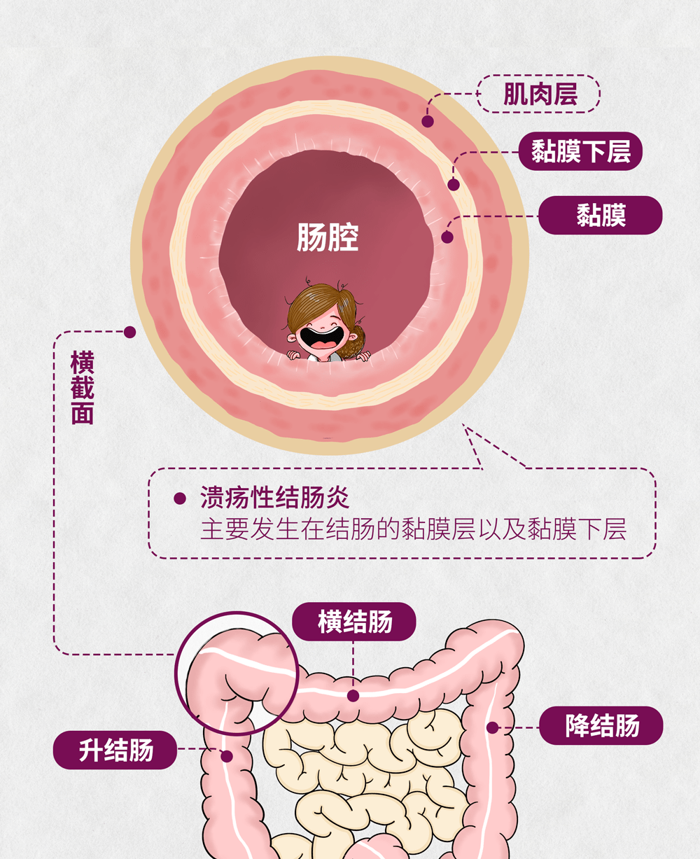 肠道横切结构图图片