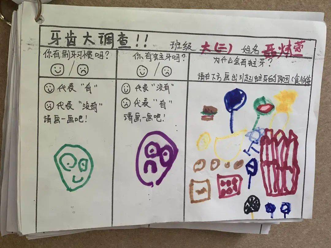 牙医讲述了正确的刷牙方式:牙刷和牙齿面倾斜45度,上牙从上往下刷,下