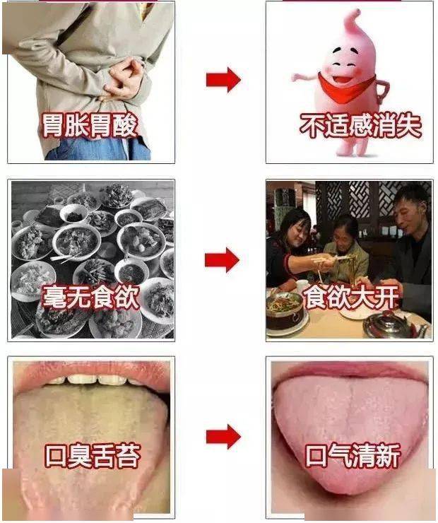 是一款纯植物提取的固体饮料属食疗范围,是专为胃疼 l 胃炎 l 消化差