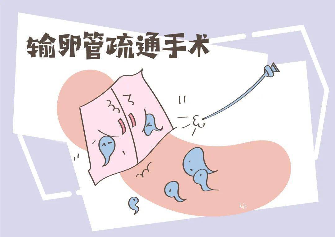 成功,医生会对女性进行相关的生育环境检查,以输卵管堵塞的女性为例