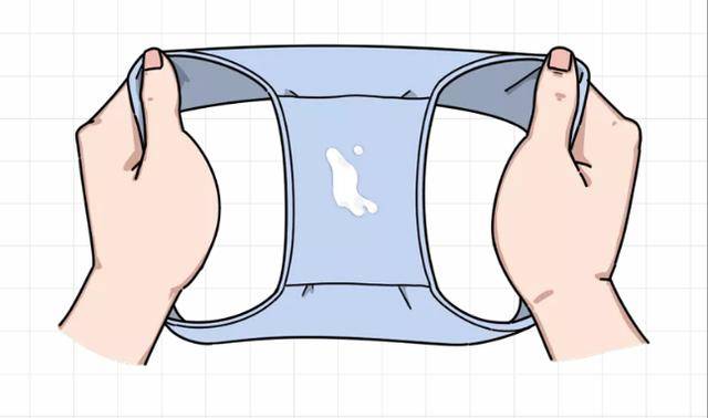 霉菌与滴虫白带是私处健康的晴雨表,正常的白带呈蛋清样或白色糊状,无