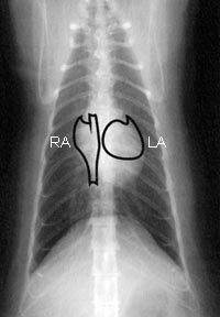 胸部x光片很难判读心脏的大小