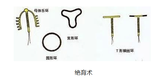 健康科普科学避孕她和他共同的责任