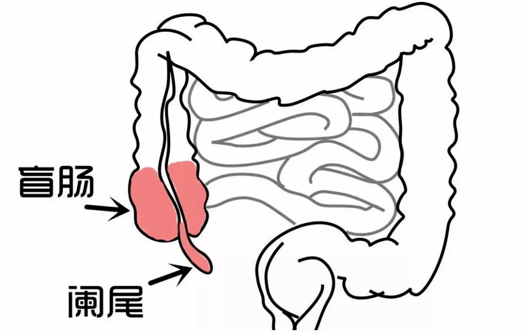 闌尾位於人體腹腔右下方,迴腸與盲腸的交界處,細長彎曲,像一條小蚯蚓.