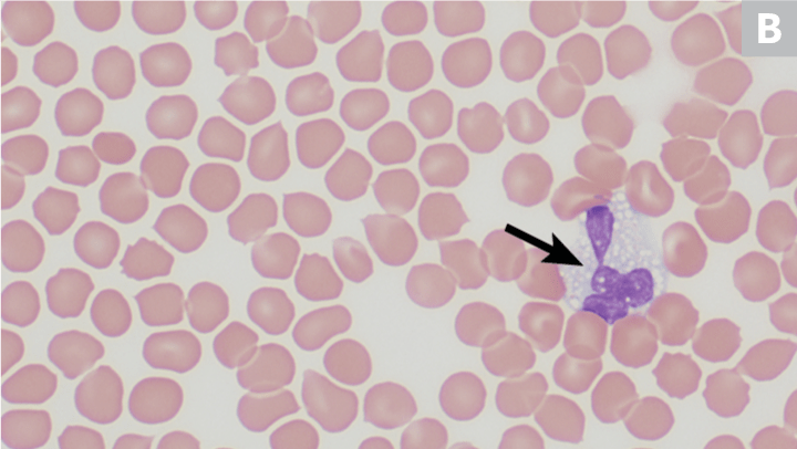 红细胞切片图图片