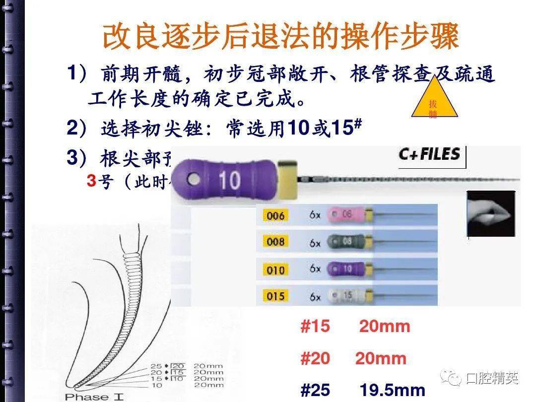 根管治疗的步骤方法器械