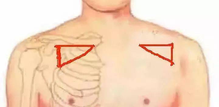 人体九大"黄金三角区",治病,致病只在一念间!