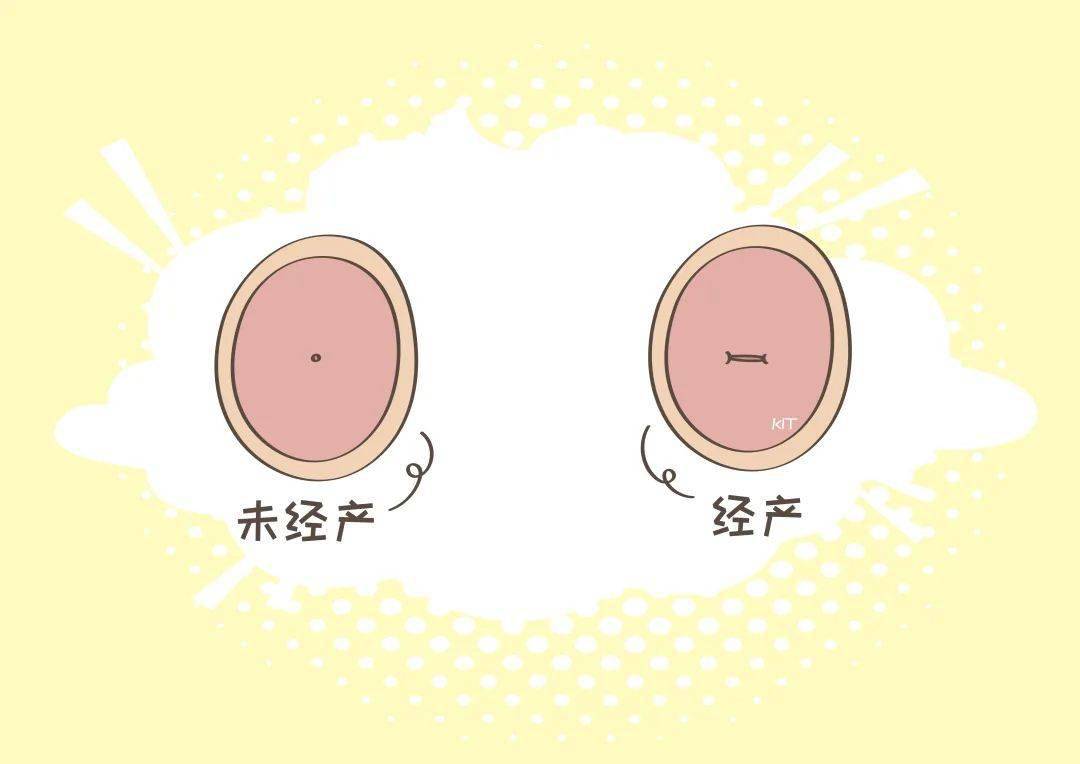 宫颈口形状不规则图片图片