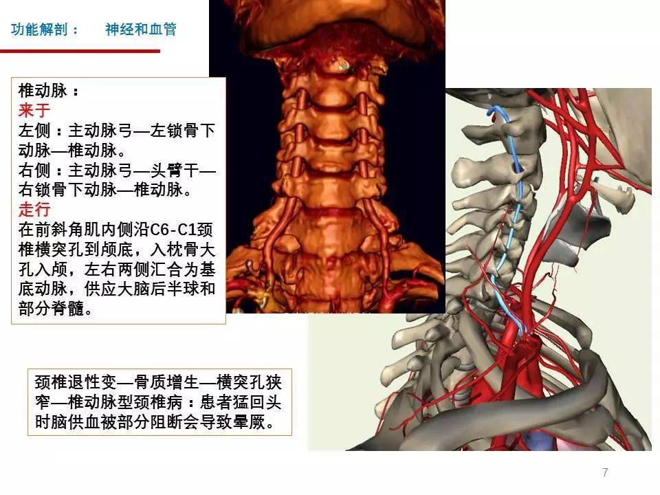 颈椎病解剖[收藏贴]