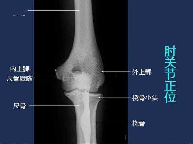 全身x線圖譜,閱片必備!_解剖