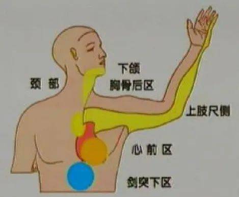干货超全急性心梗的识别与处理赶紧存起来