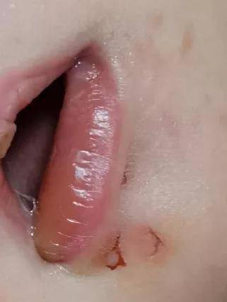 出生仅11天的婴儿被老鼠咬得浑身是血哭得撕心裂肺