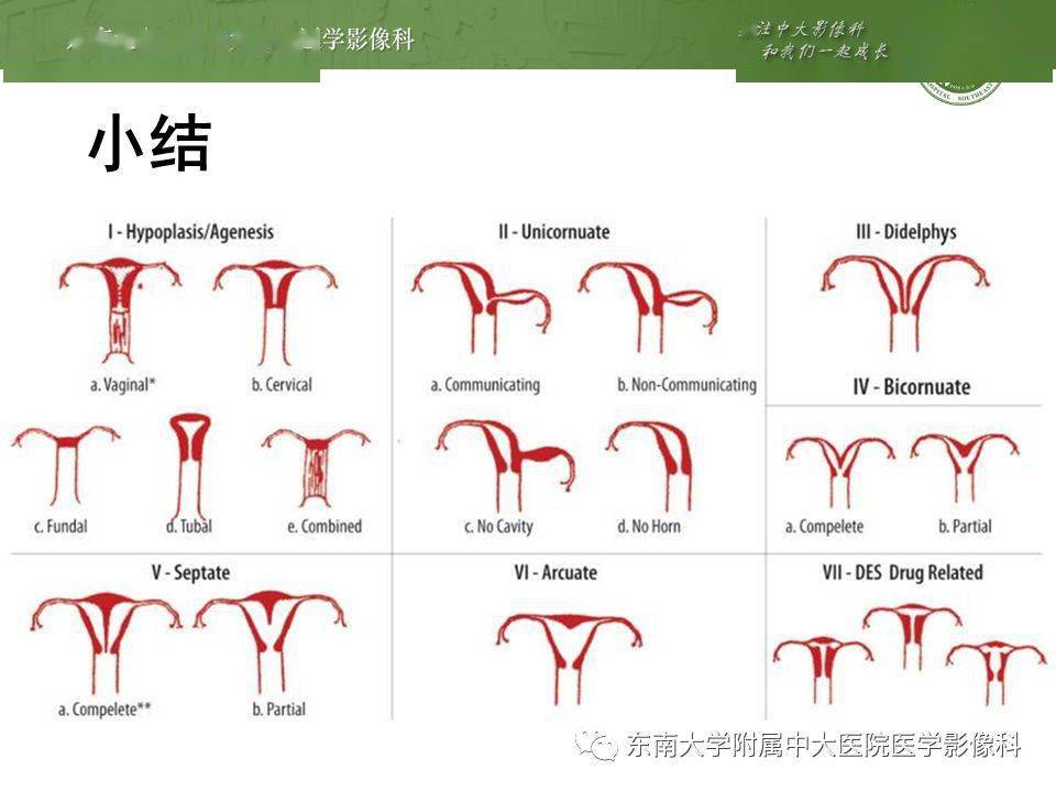 畸形子宫形态图片