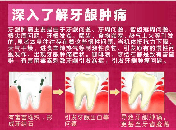 常见的牙龈炎,往往与这6大诱因有关!快来看你属于哪种