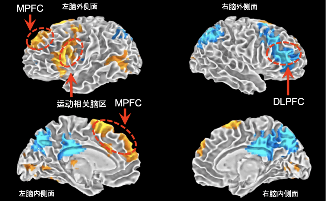 说唱歌手表演freestyle时大脑中发生了什么