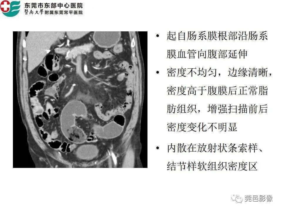 脂膜炎CT图片