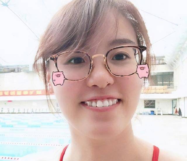 傅园慧整牙后颜值前后判若两人孩子牙齿整洁很重要