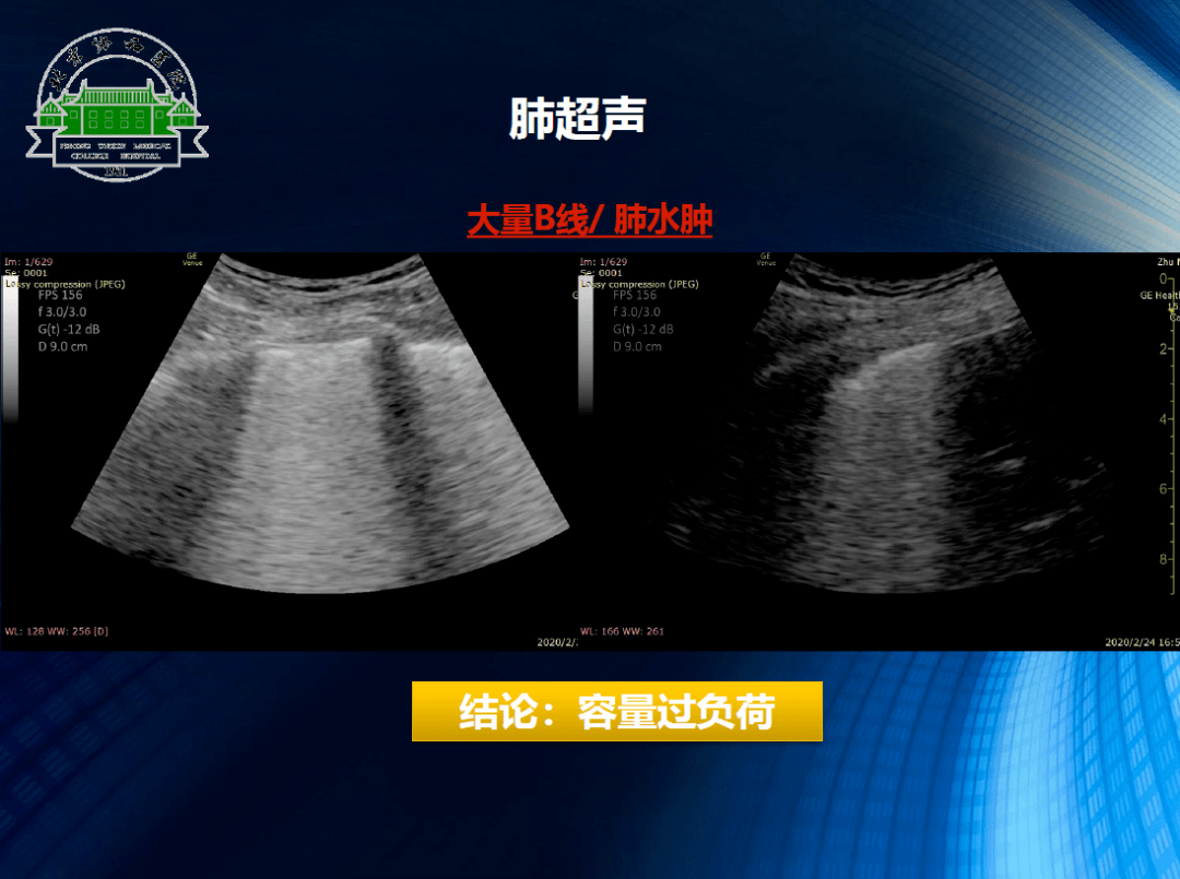 担任主编专业教材1部《术中经食管超声心动图的价值与实践》