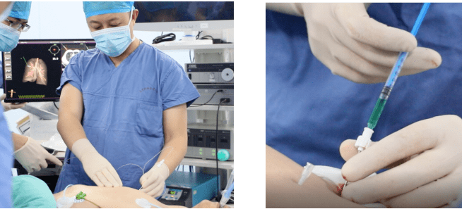 按照导航系统的指示,经皮穿刺至目标位置,注射吲哚菁绿