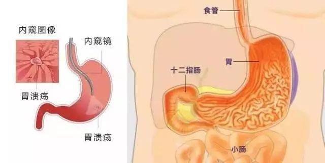 胃镜各个部位名称及图图片