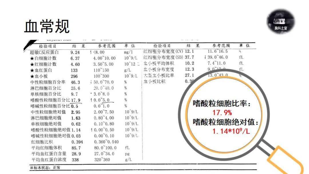 肺內遊走性病變伴嗜酸粒細胞升高一例