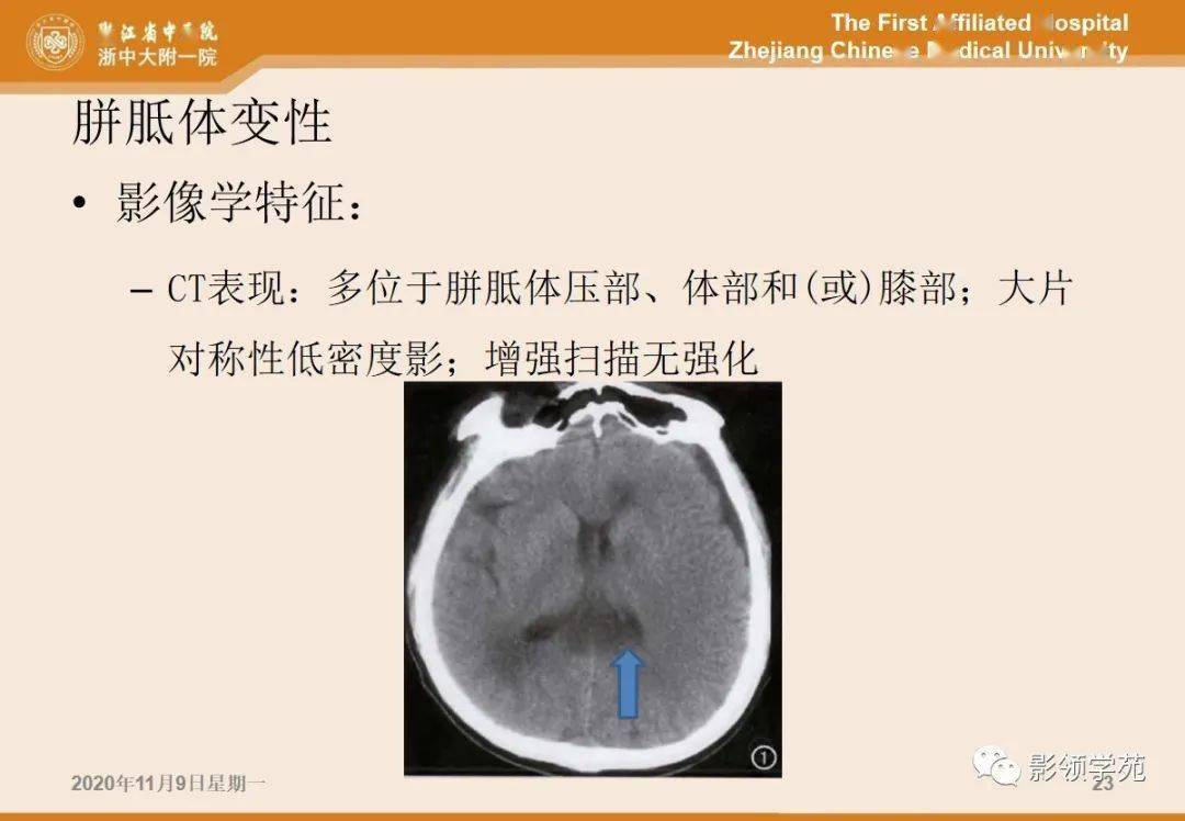 5类胼胝体病变的影像学表现