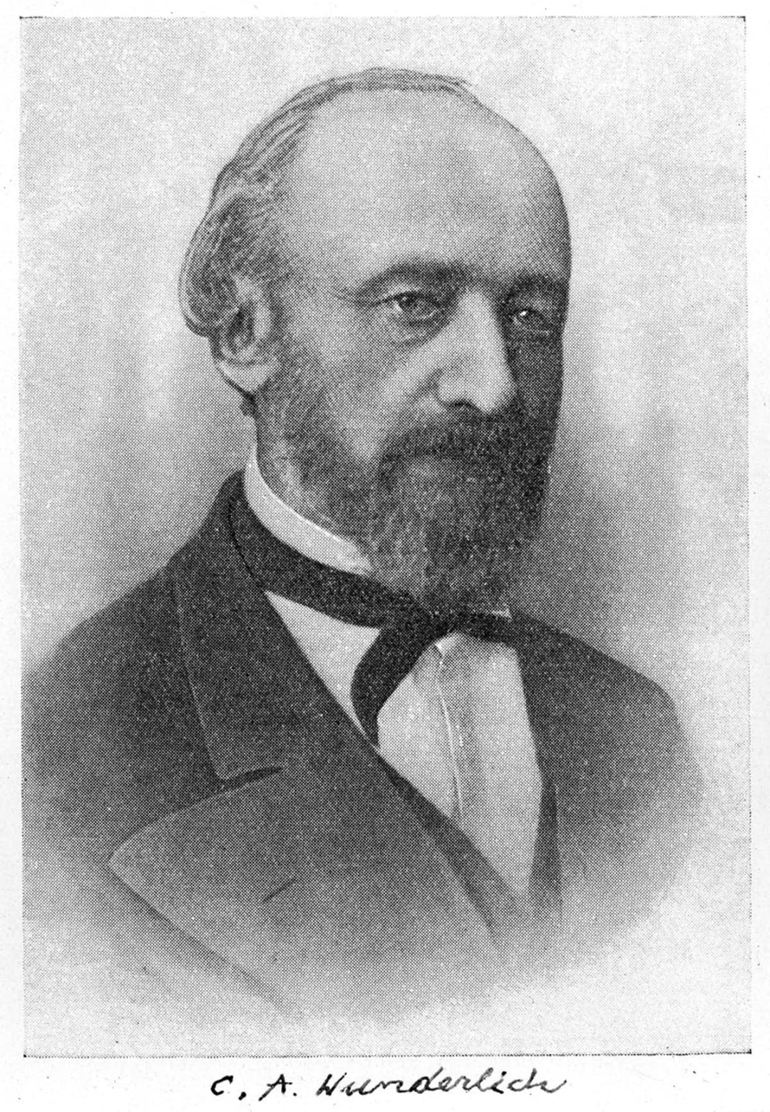 1851年,德国内科医生卡尔·温德利希(carl wunderlich)在收集了莱比锡