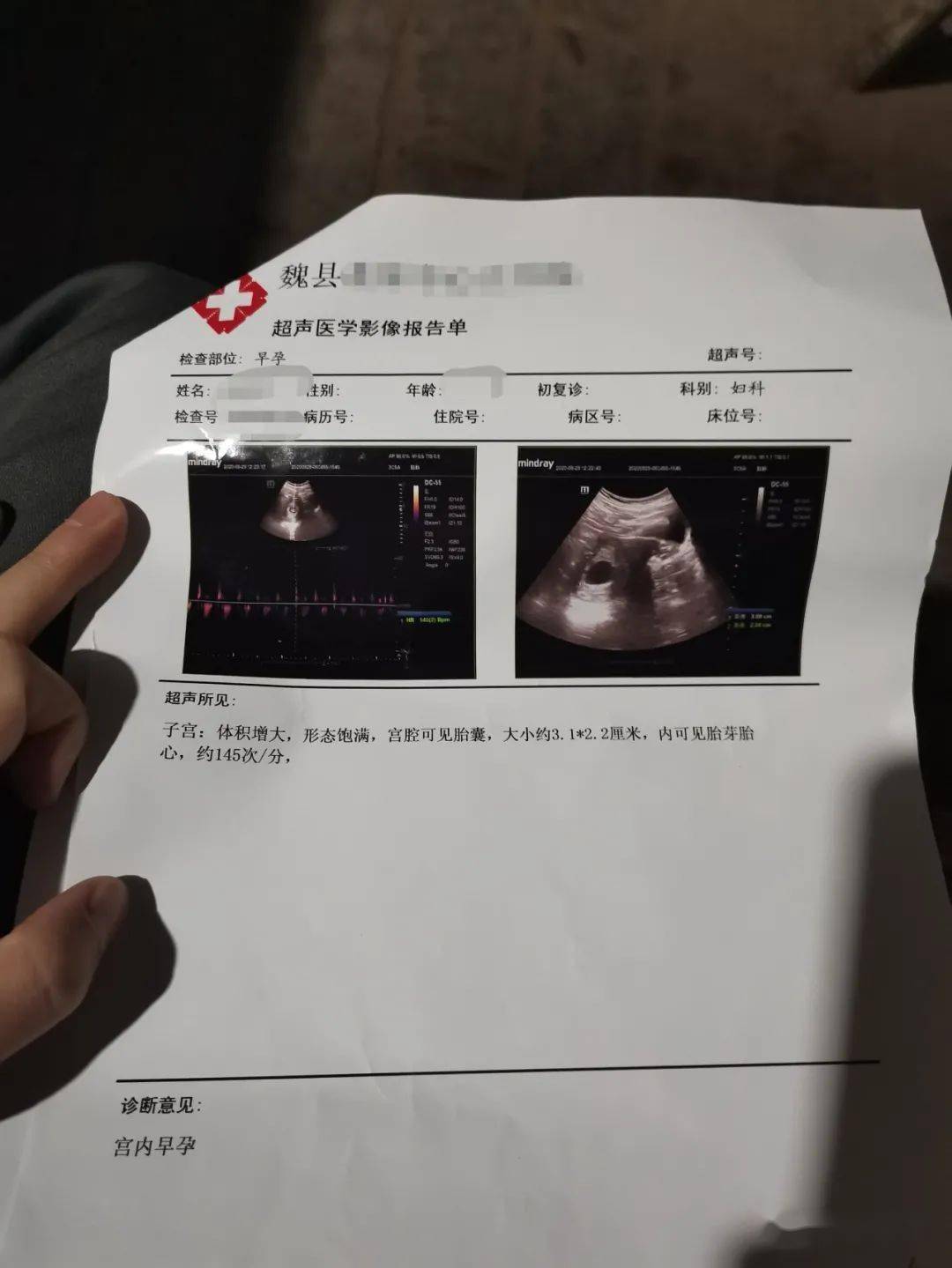 怀孕检查照片证明图片