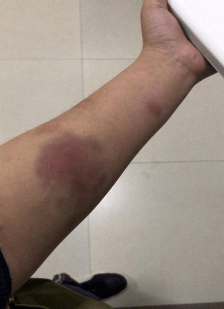 夺冠专访研究生院女排队员张家莉