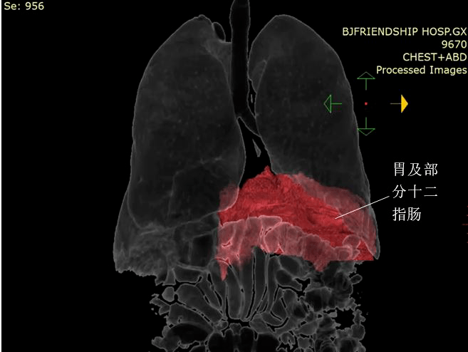 我們胸腔和腹腔之間由一層扁平肌肉分隔,叫作膈肌.