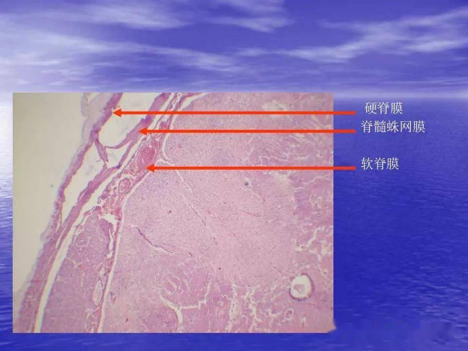 精彩课件硬膜外麻醉误入硬膜下隙的解剖学研究