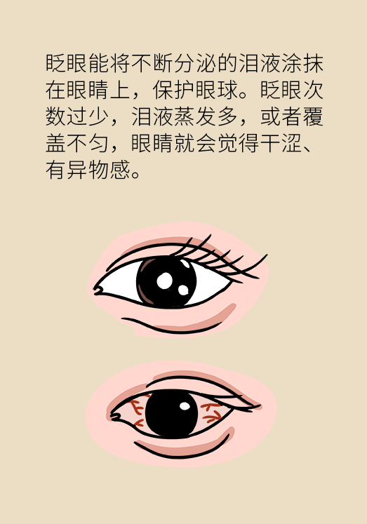 【科普】熬夜追剧后眼睛干涩疼痛?小心患上这两种病!