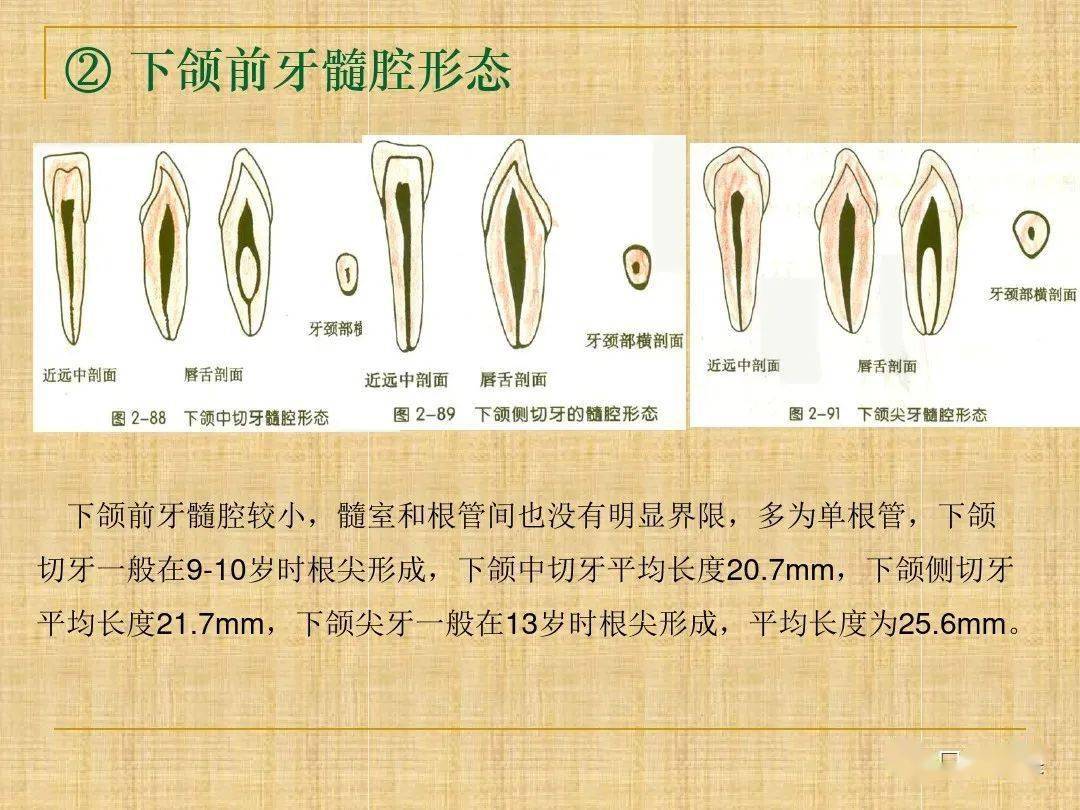 下颌乳磨牙根管分布图片